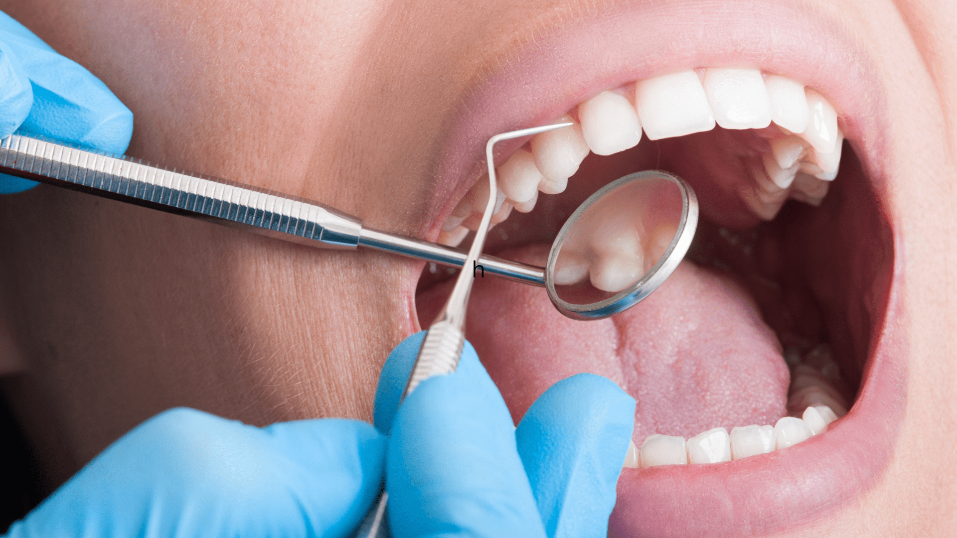 Patient getting teeth Examined | Dentist Louisville, KY