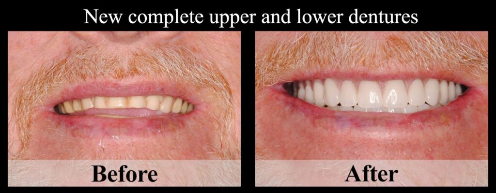 Before and After Result